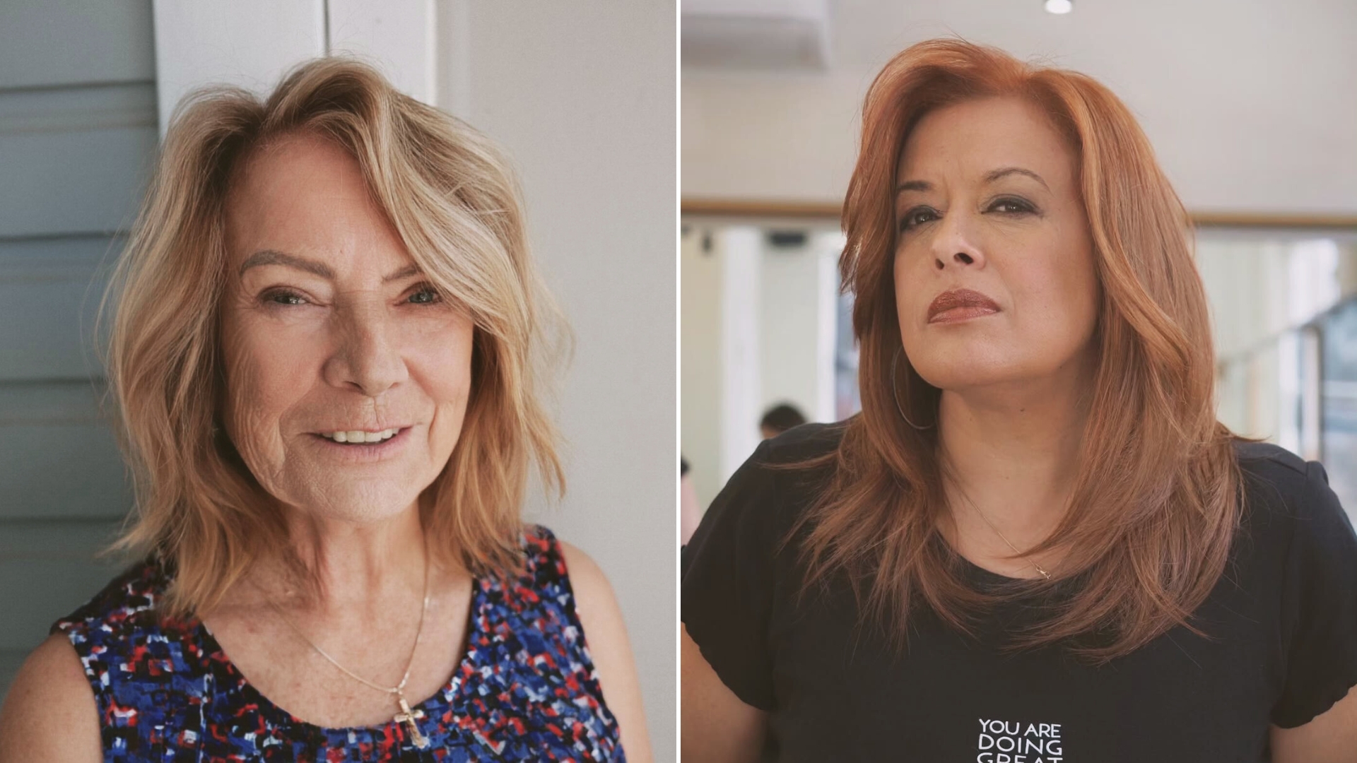 How To Stop Thinning Hair From Aging You—33 Styles That Bring Your Hair Back To Life