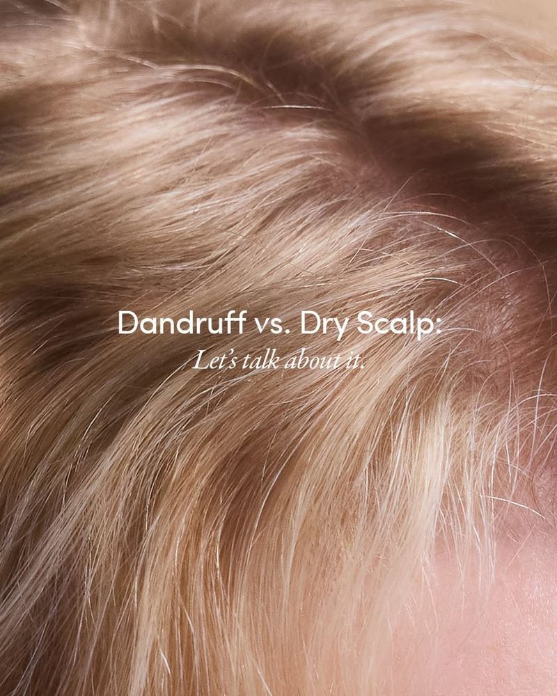 Myth 11: Dandruff is Caused by Dry Scalp