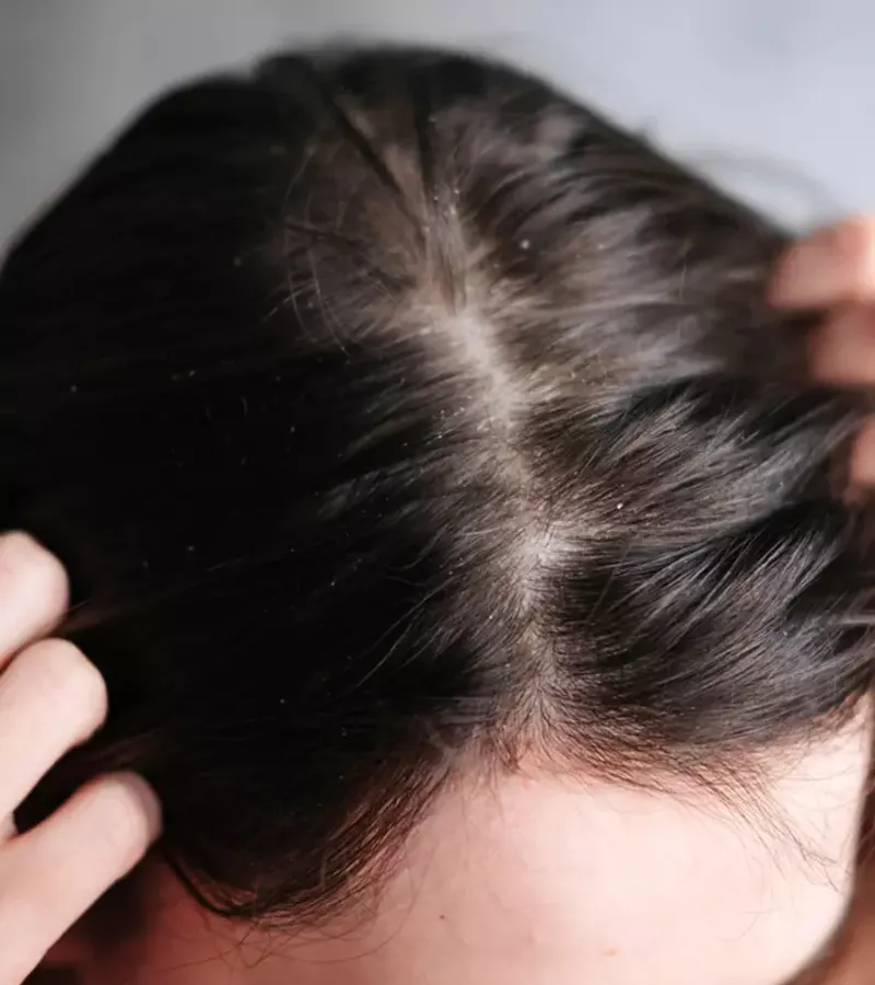 Hair Product Buildup
