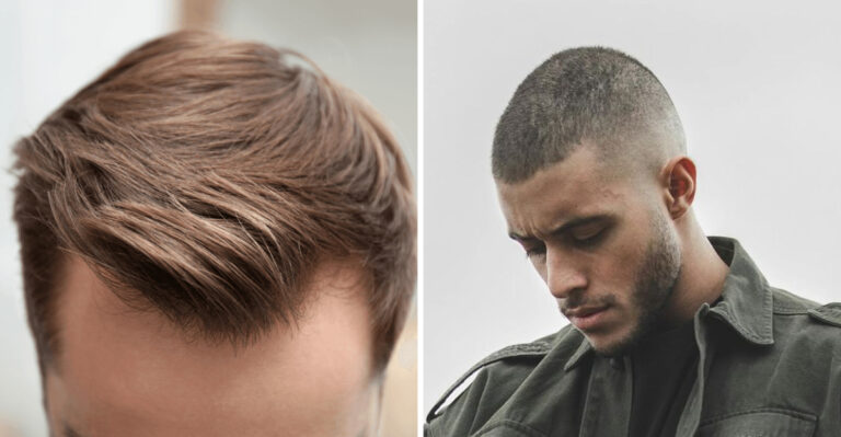 9 Smart Ways Stylists Tackle Receding Hairlines (and 6 Things That Make It Worse)