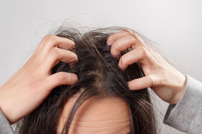 Scalp Becomes Irritated
