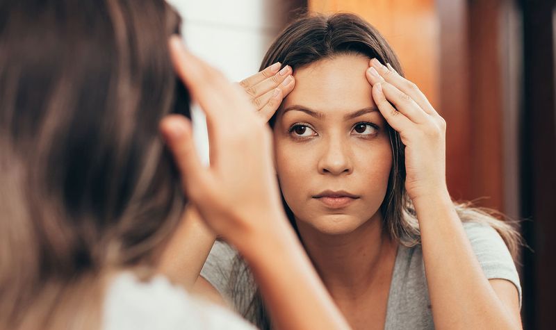 Comedogenic Concerns for Hairline