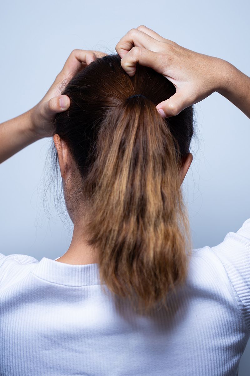 Scalp Irritation