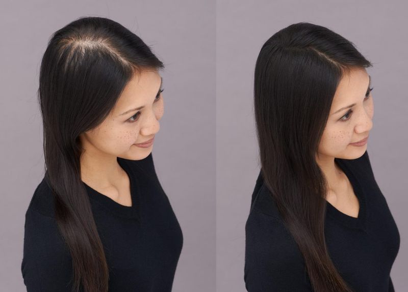 Strand Thickness Variations