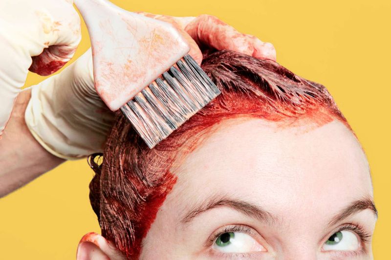 Hair Loss