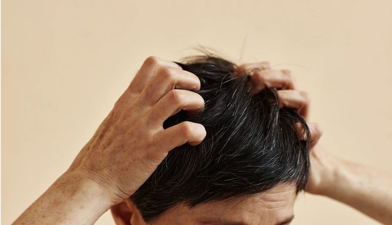 Scalp Issues Enter the Chat