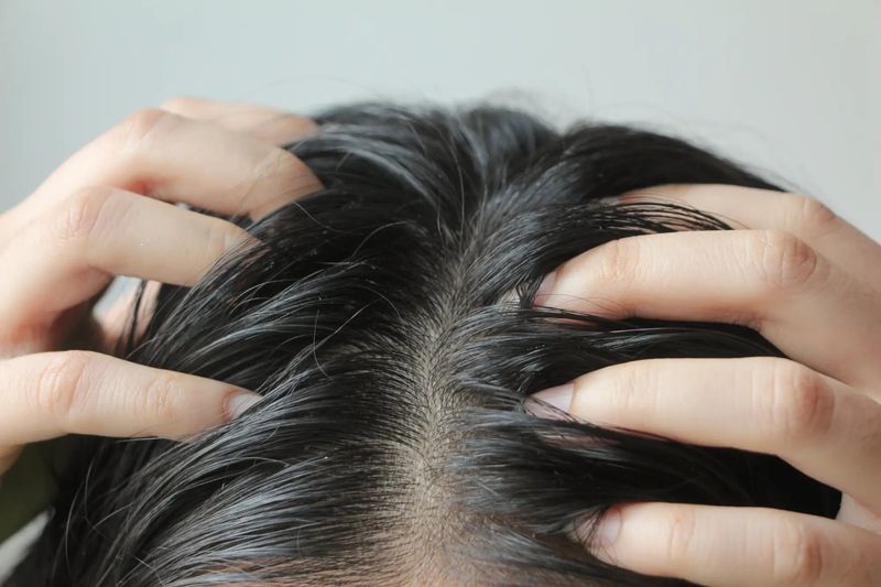 Scalp Conditions Require Customization