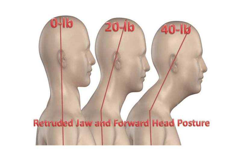 Heavy Extensions Pulling Your Head Forward