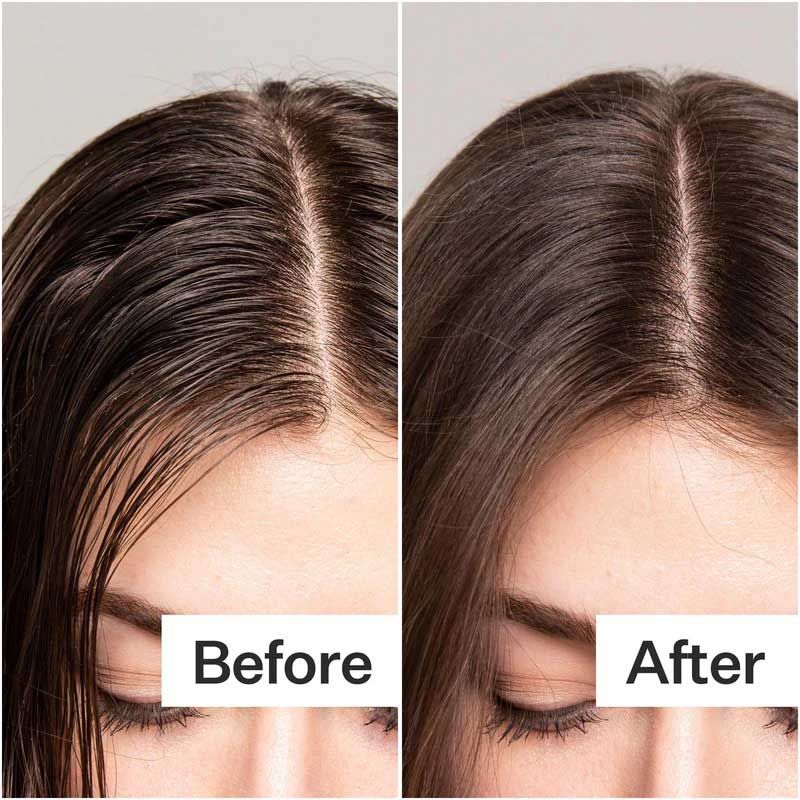 Invest In Dry Shampoo