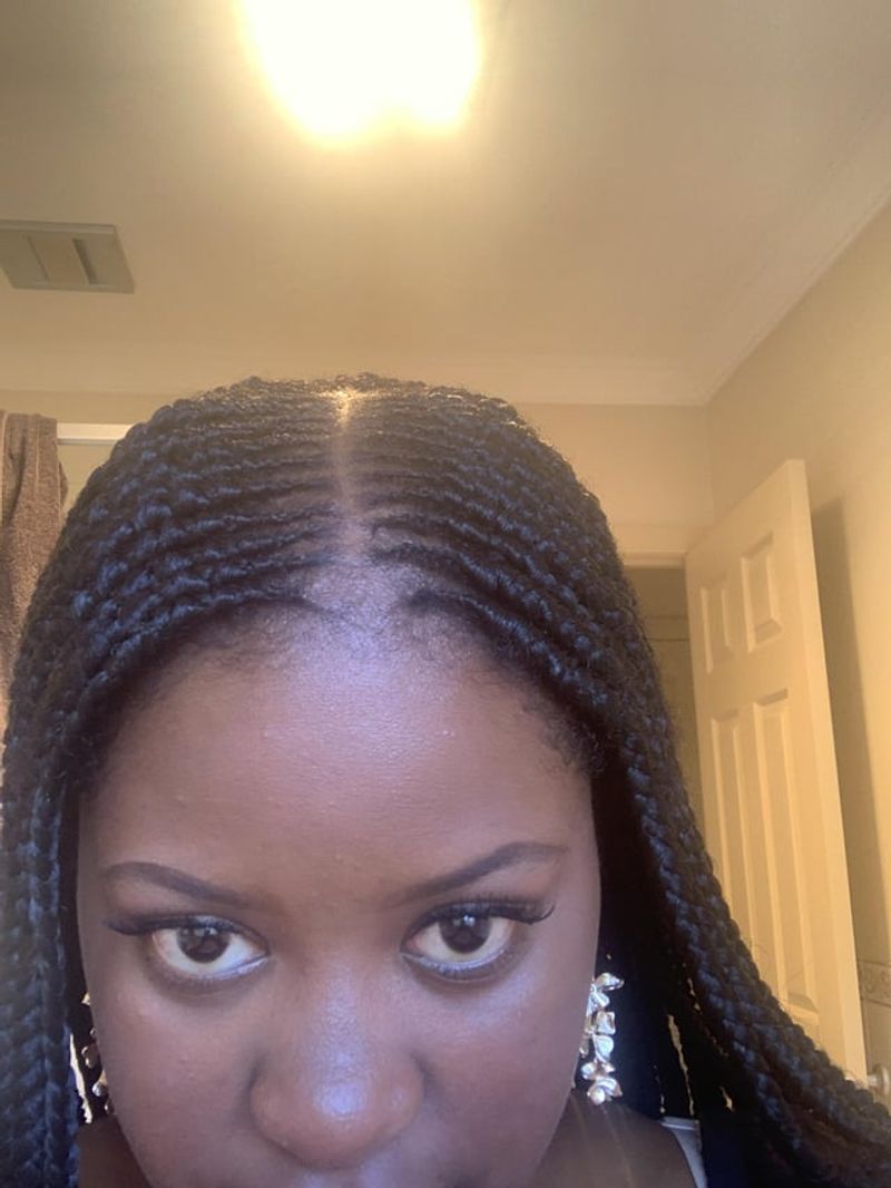 DAMAGE ALERT: Too-Tight Braids