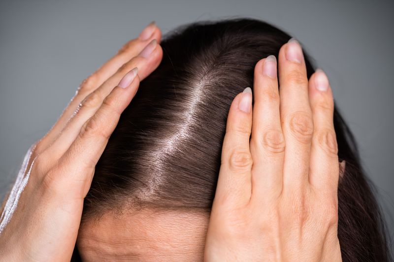 Changing Parts Prevents Hair Damage