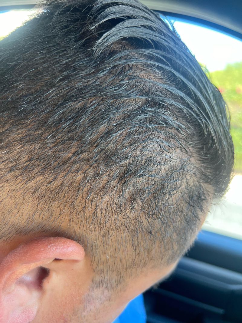 Slicked-Back Styles Reveal Every Sparse Spot