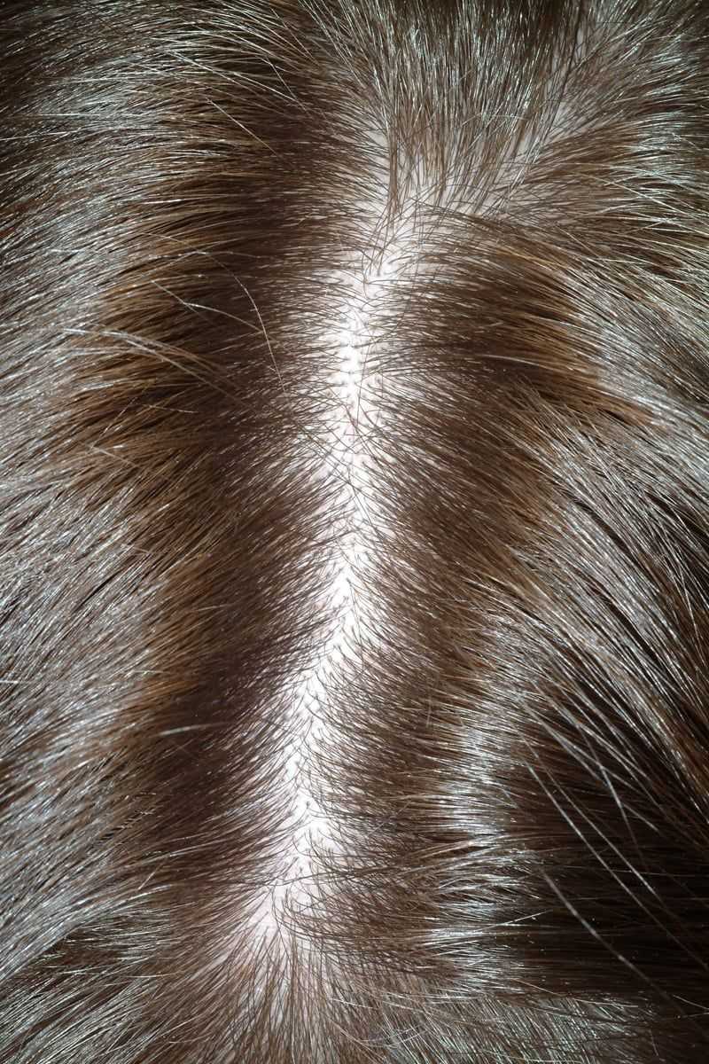 Cortisol Spikes Can Trigger Sudden Shedding