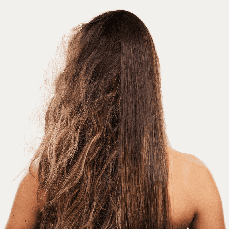 Role of Sleep and Hair Health