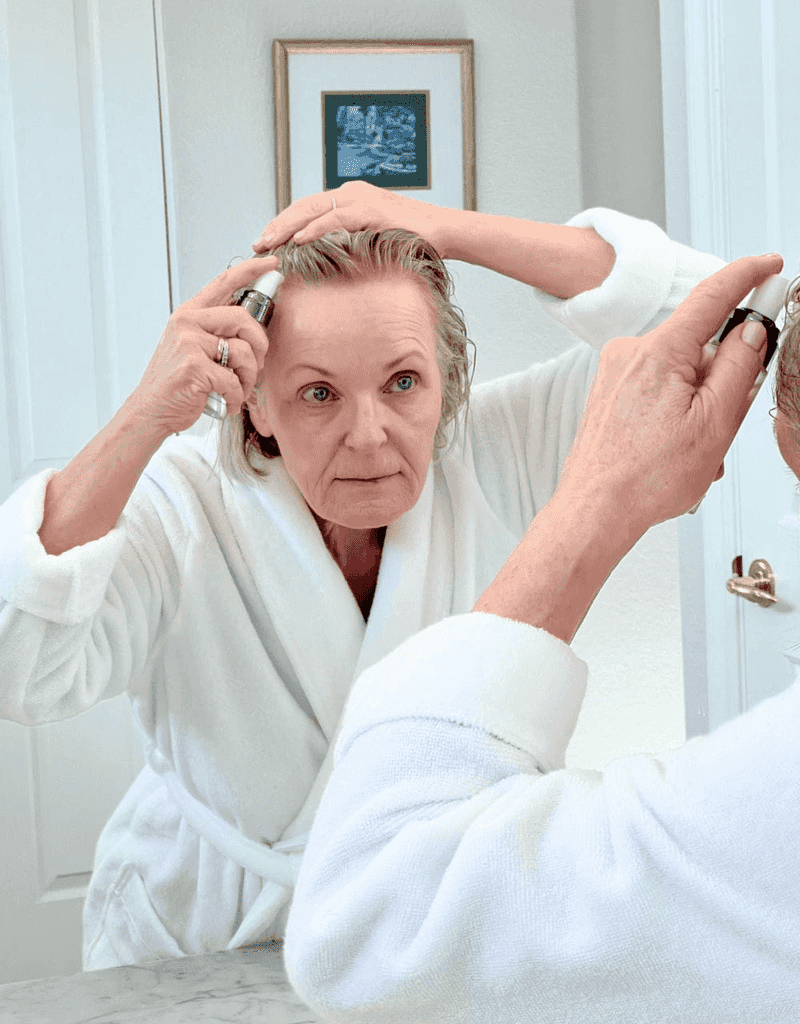 Hair Loss Confrontations