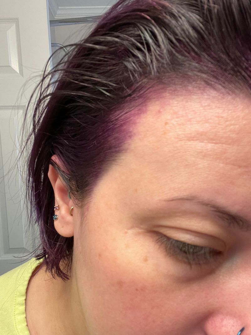 Permanent Staining
