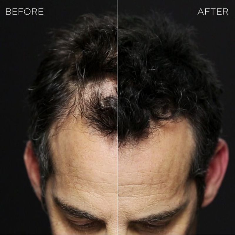 Hair Fibers for Instant Results