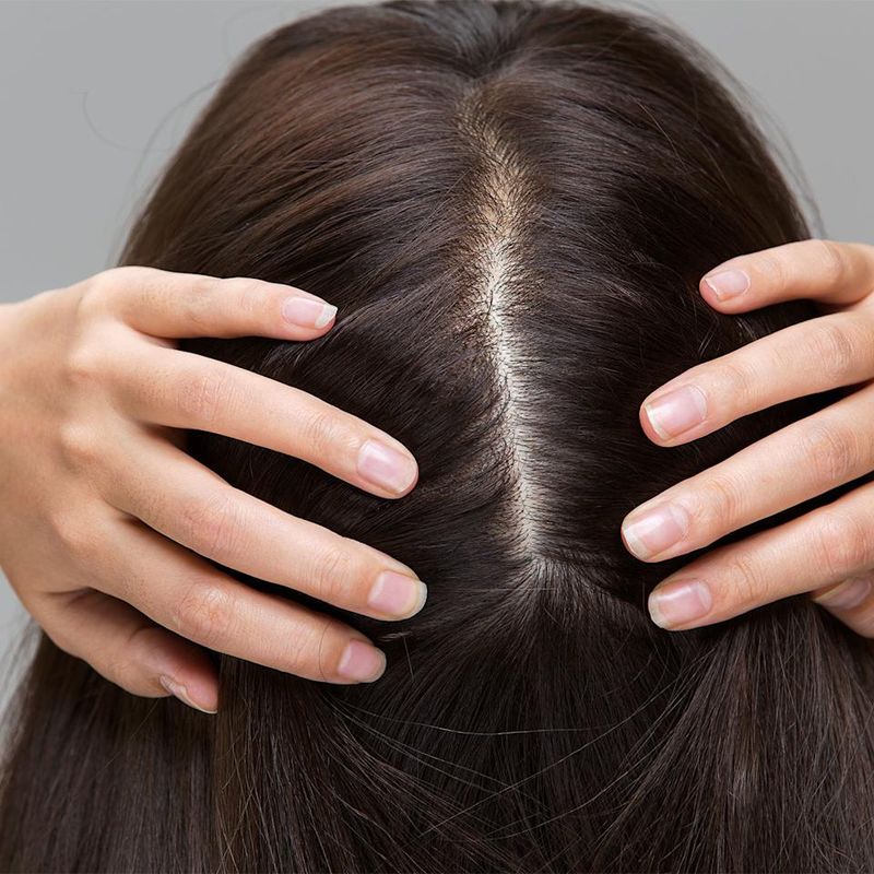 Severe Center Parts Expose Scalp