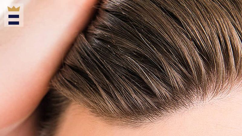 Dandruff Confusion Leads to Wrong Treatments