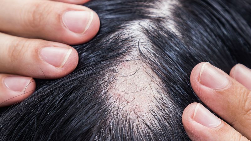 Harsh Chemical Treatments