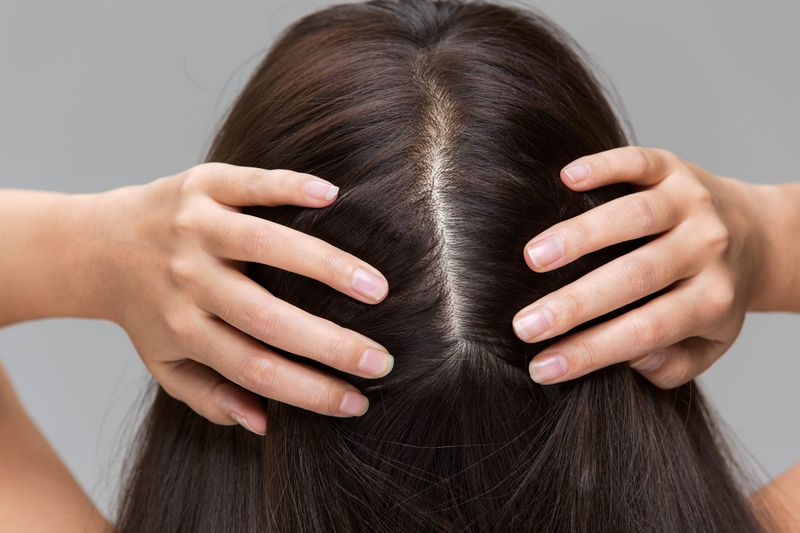 Scalp Health Directly Impacts Hair Growth