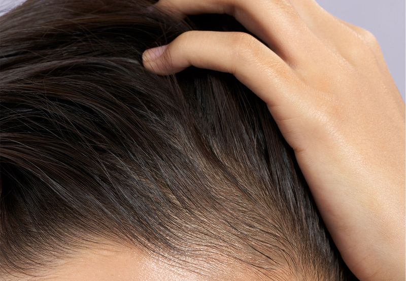Scalp Health Impacts Part Appearance