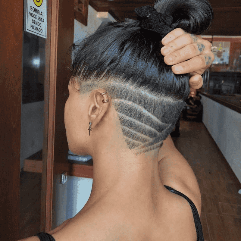 Worst: Severe Undercut