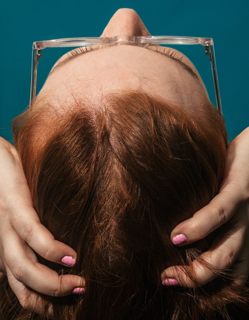 Scalp Issues Surface Unexpectedly