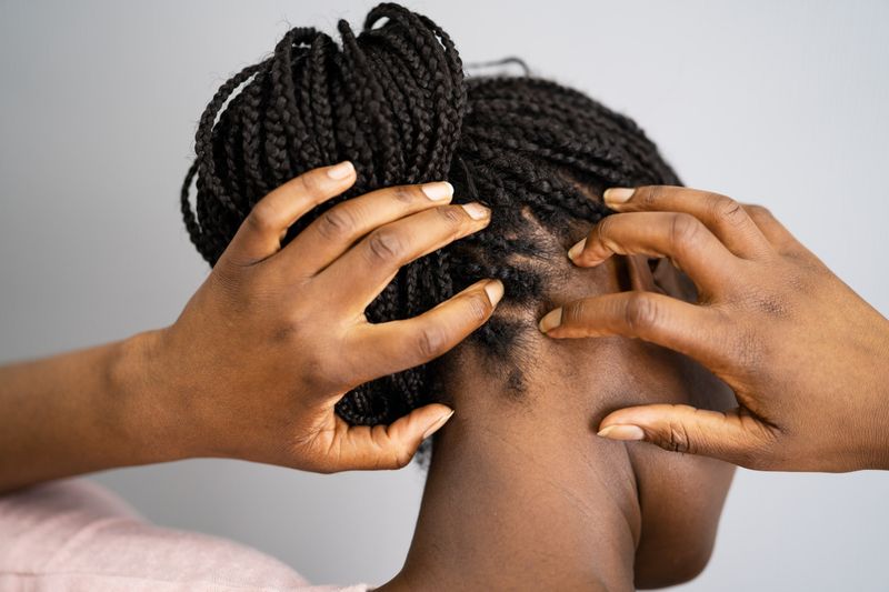 Scratching Your Scalp With Fingernails