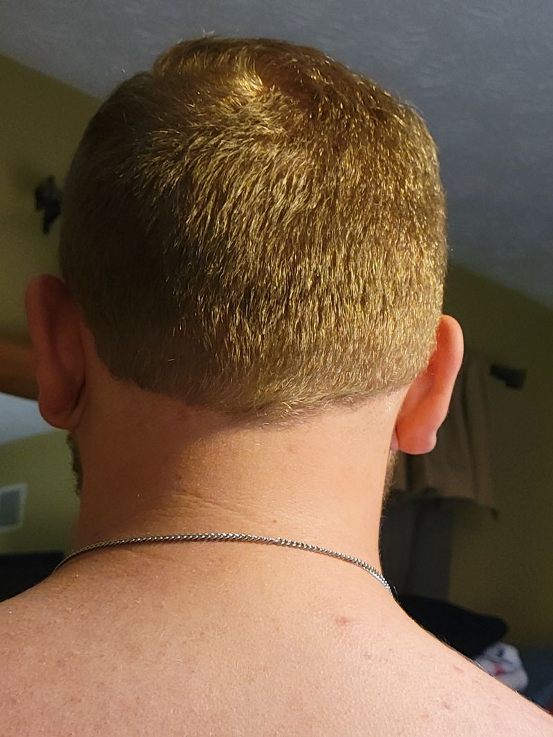 Nape Nightmare