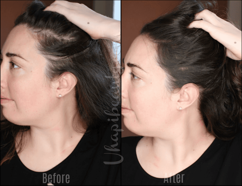 Scalp Concealing Sprays