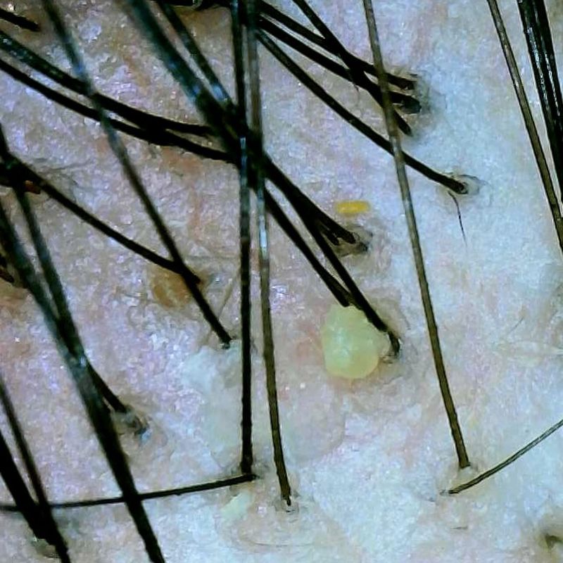 Scalp Is Skin Too
