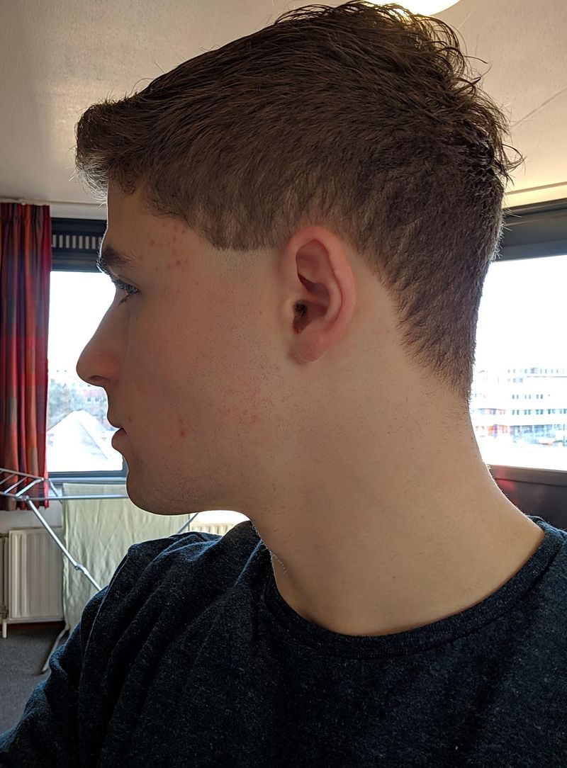 Sideburn Surprise
