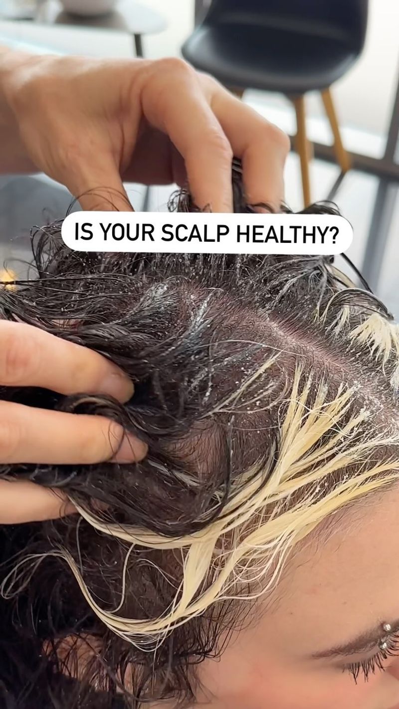 Scalp Care Promotes Youthful Growth