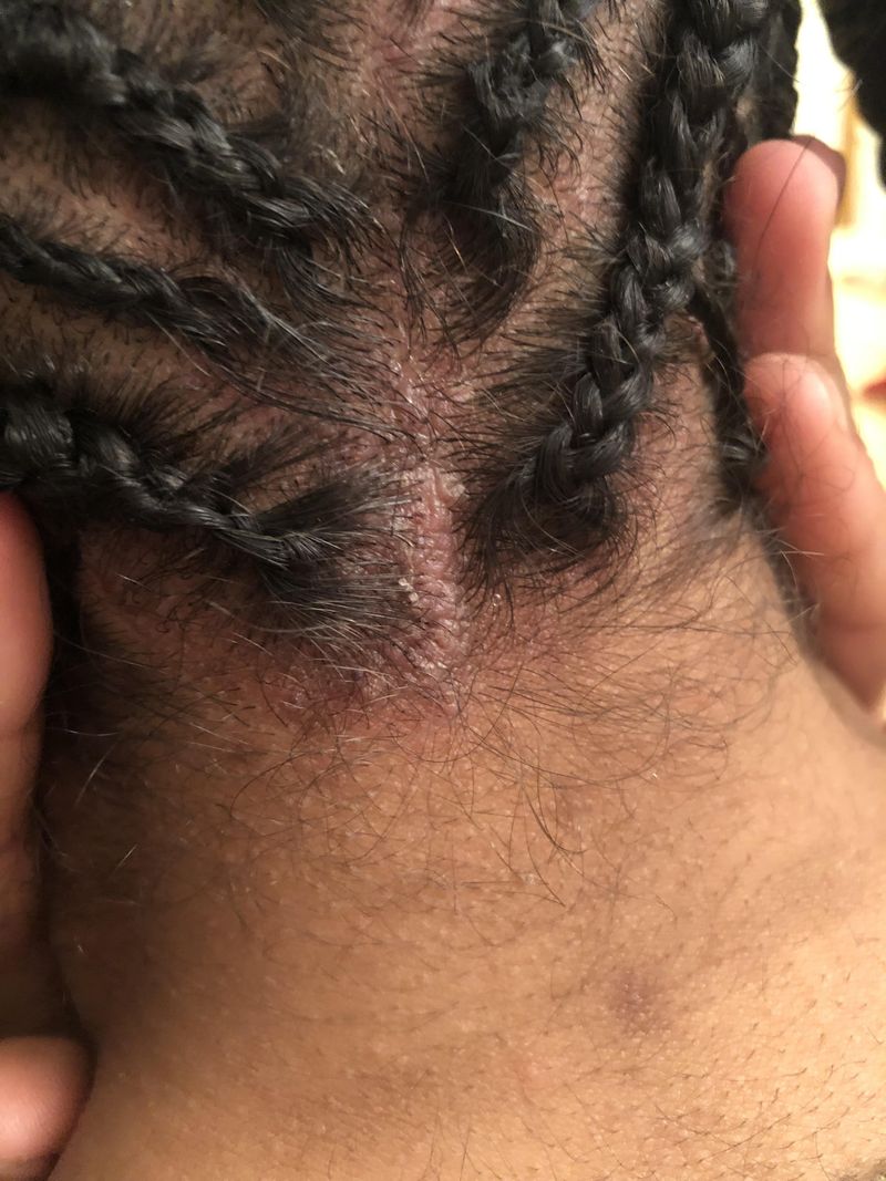 Braids With Rough Synthetic Hair