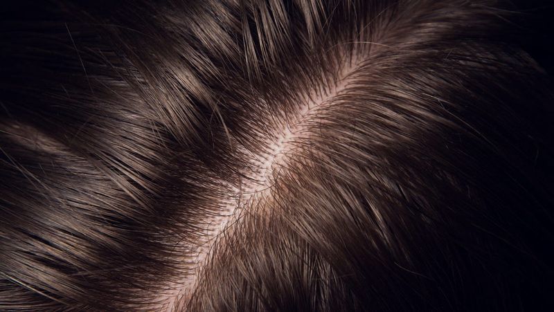 Root of Hair Problems