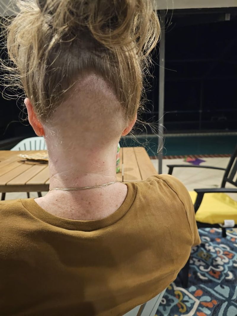 Undercut Overreach