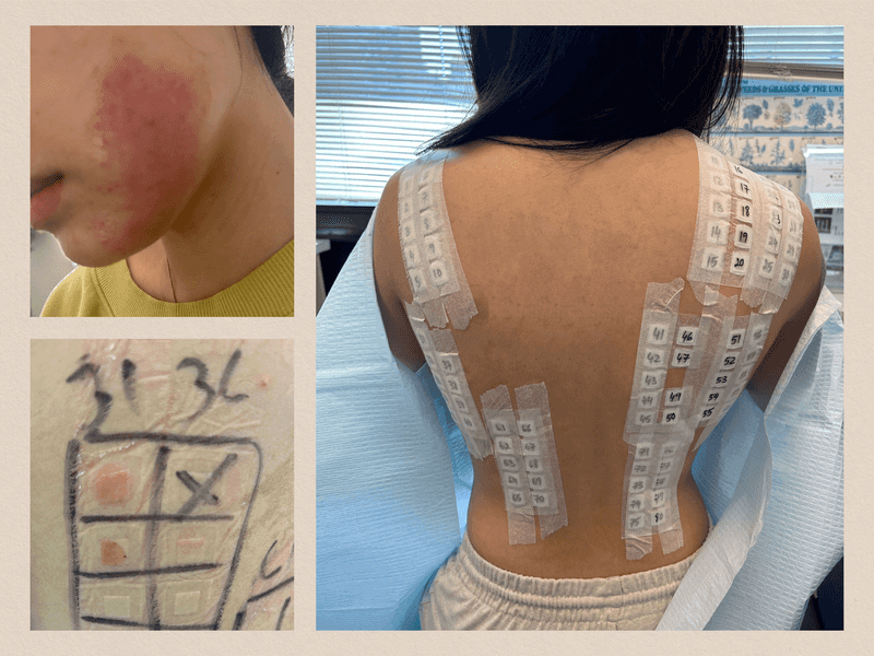Patch Testing Routine