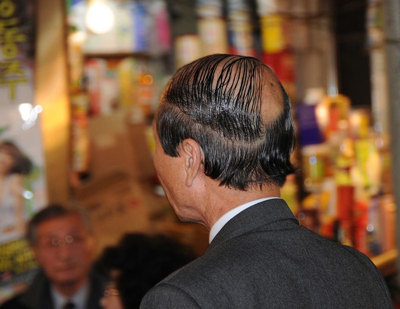 The Combover (Don't Do It!)
