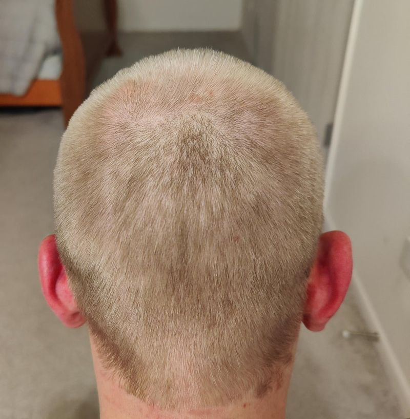 Buzz Cut Blunder
