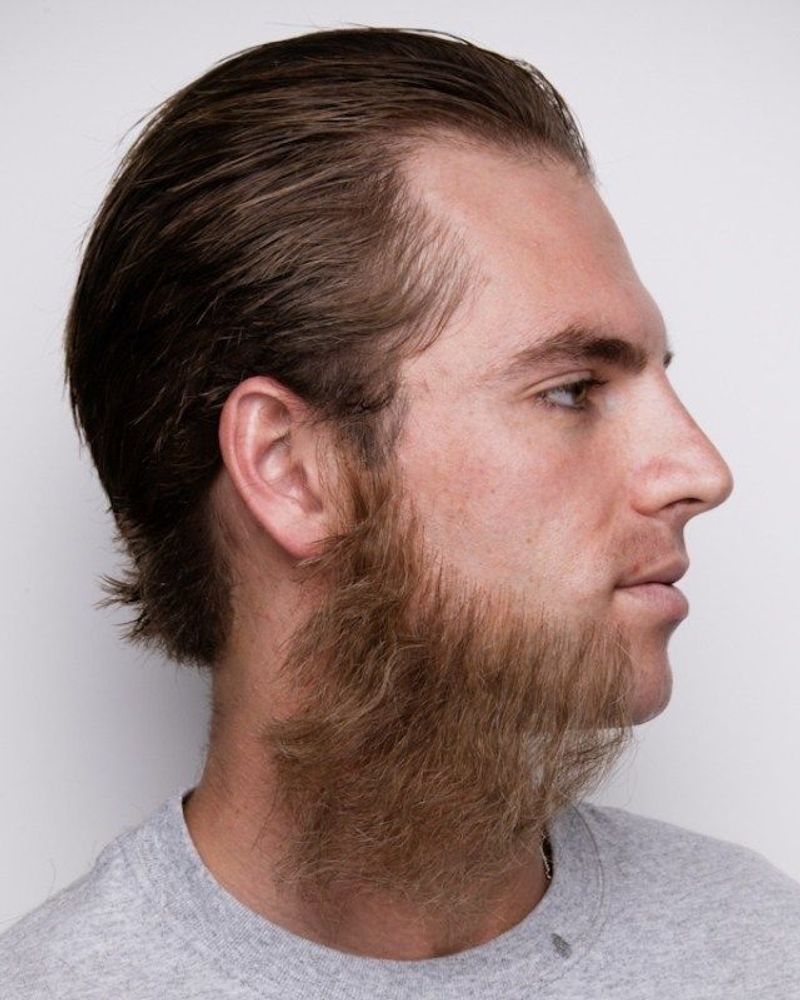 The Overgrown Sideburns
