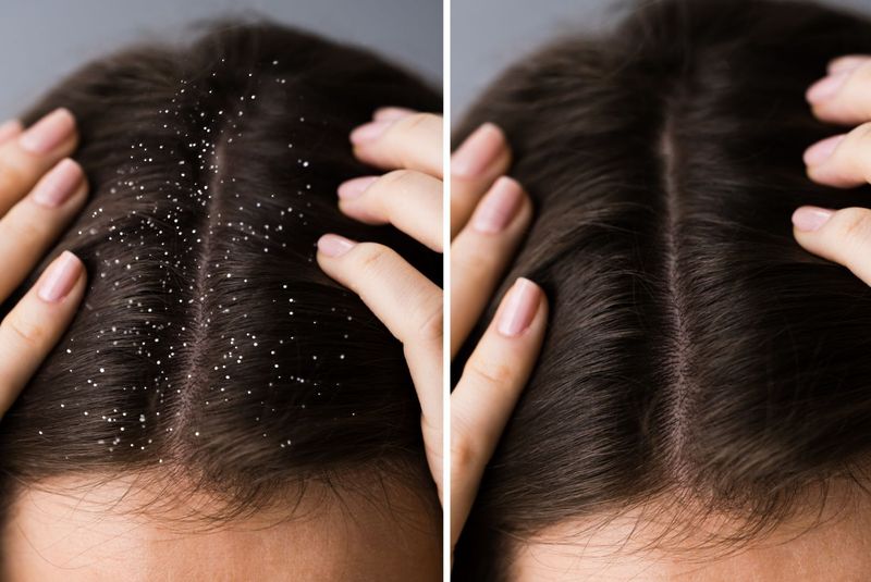 Clarifying Treatments Remove Product Buildup