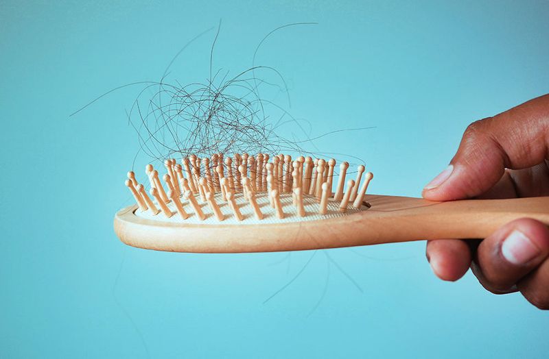 Excessive Shedding
