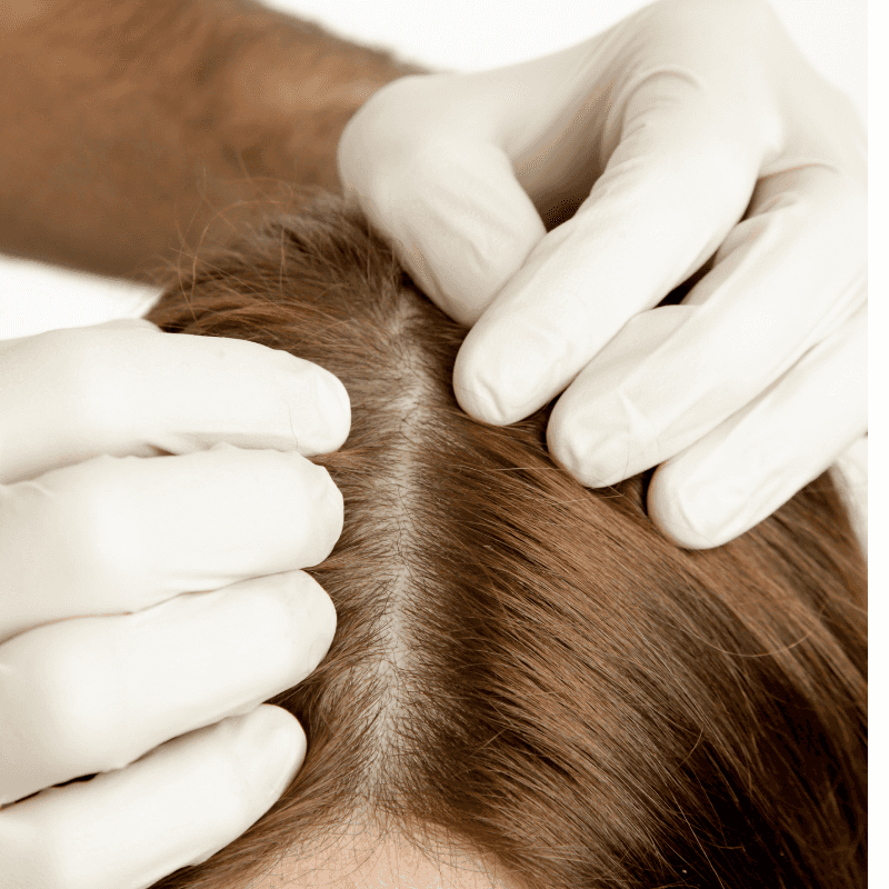 Scalp Health Importance