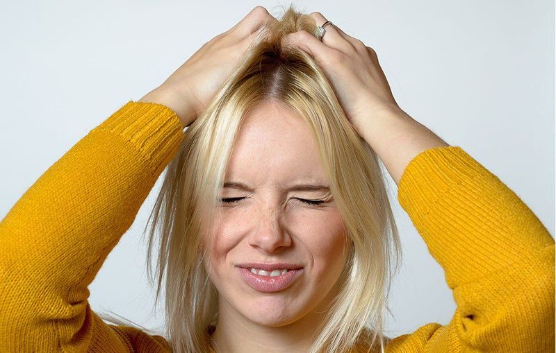 Sneaky Seborrheic Dermatitis