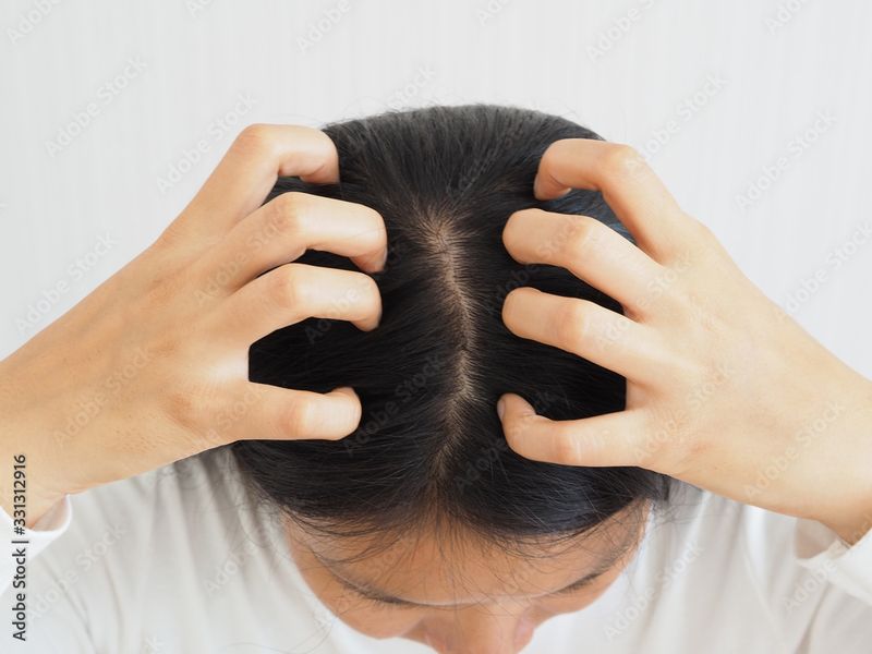 Head Lice Hitchhikers