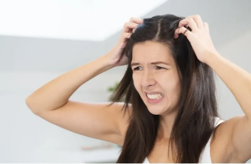 Itchy Scalp Won't Quit