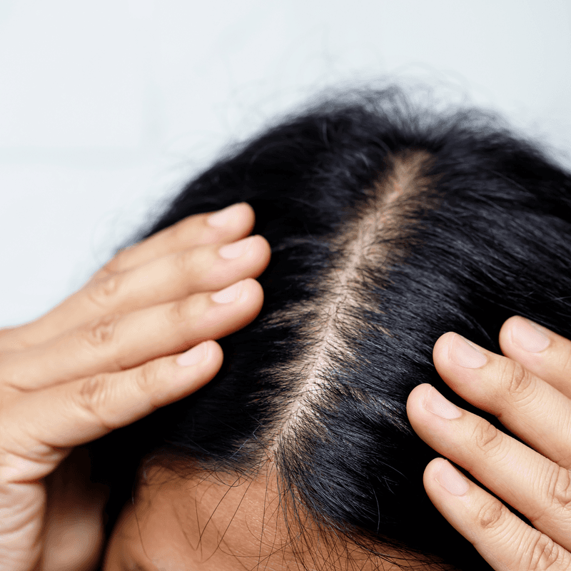 Diet Affects Scalp Oil Production