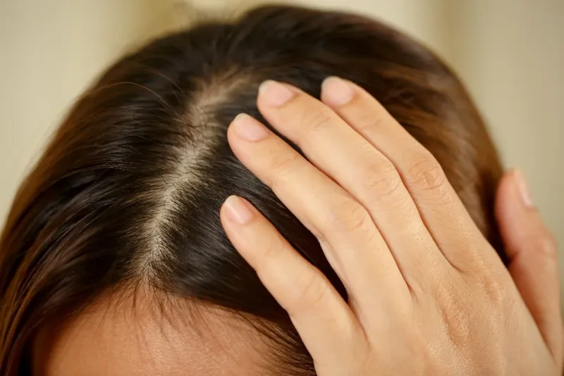 Soothes Dry Scalp