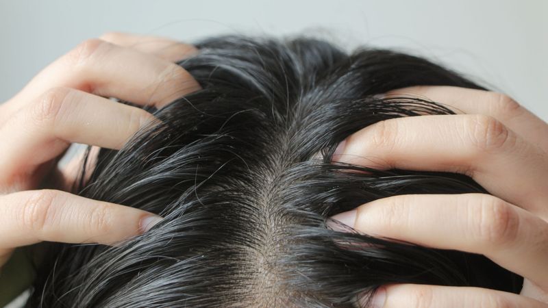 Scalp Irritation Risks